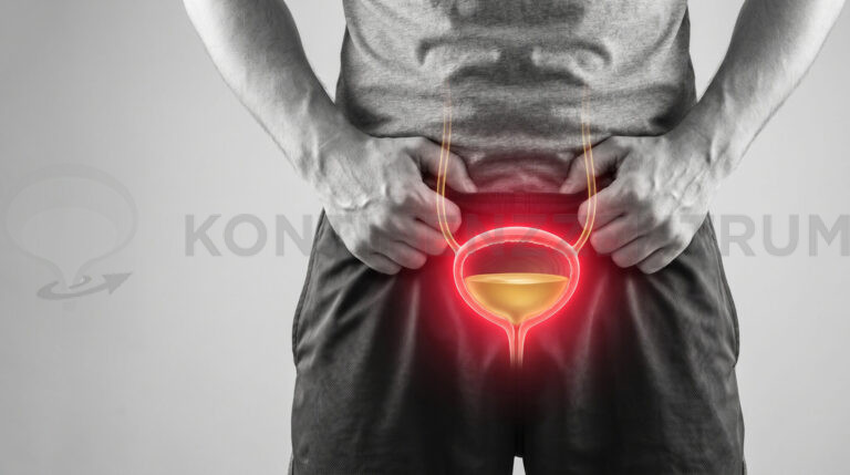 Wenn Restharn bleibt: Bewährte Elektrostimulation bei schwachem Blasenmuskel