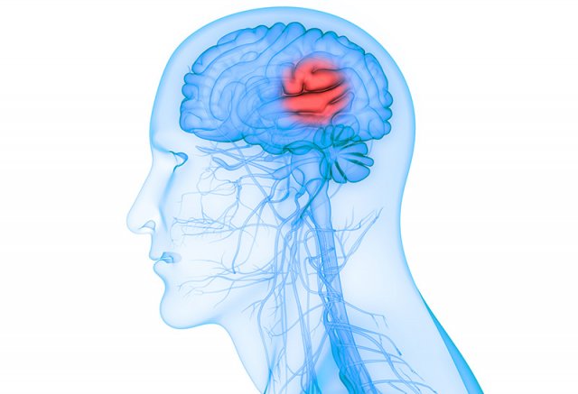 Neurourologie untersucht die Verbindung zwischen Blasenstörung und Hirnverletzung.