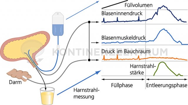 Urodynamische Funktionsuntersuchung 