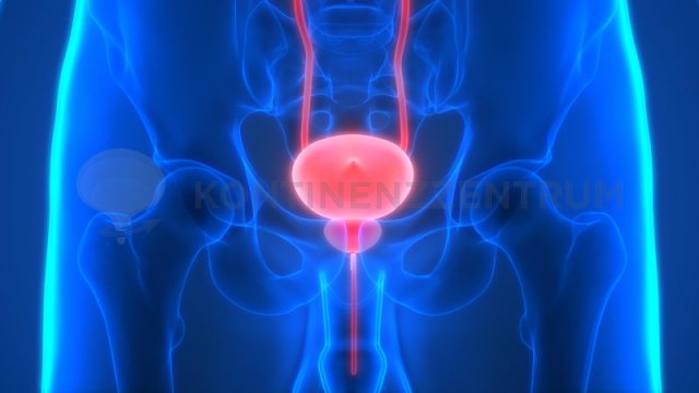 Bei einer Prostataentzündung gibt es mehrere Methoden zur Behandlung