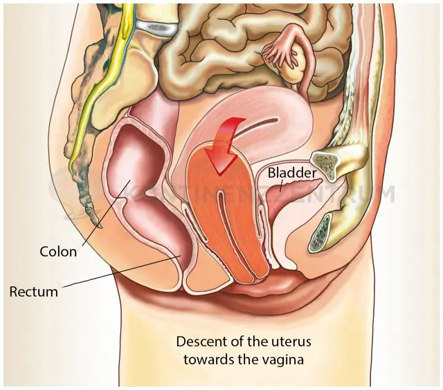 Saggital section of the uterus